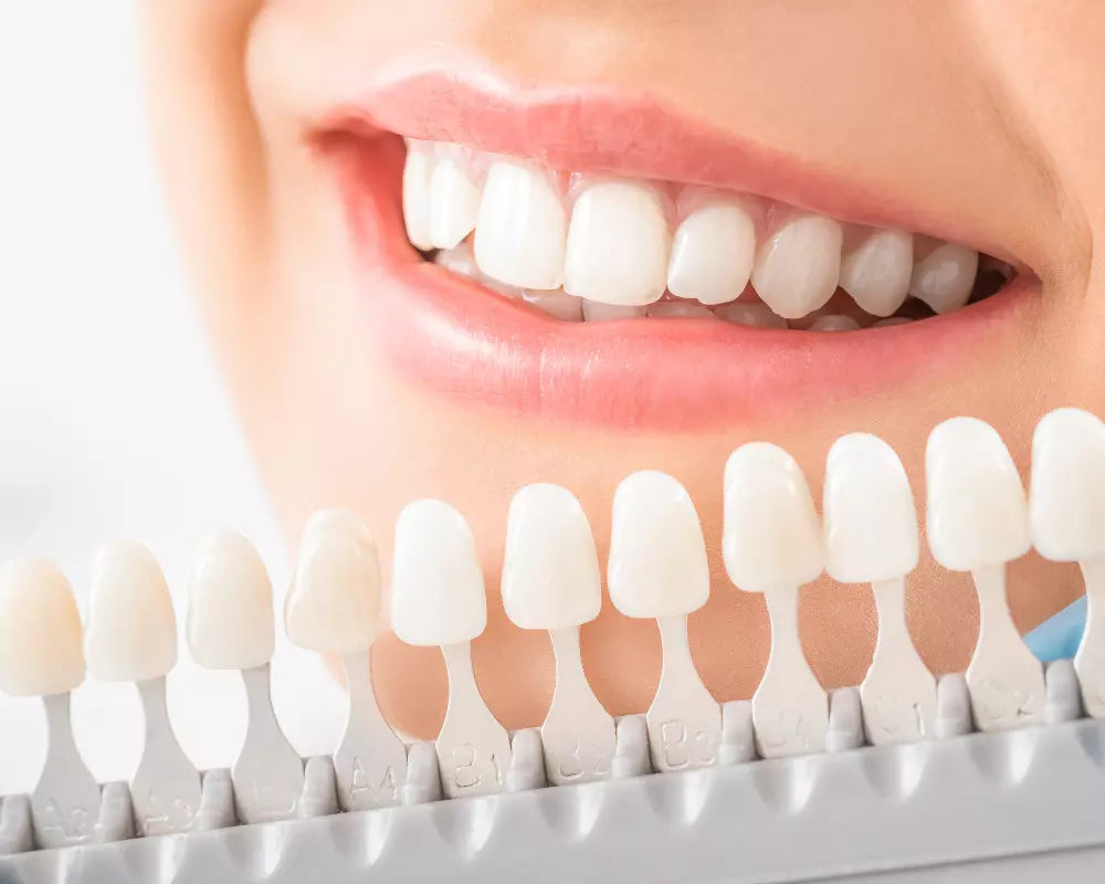 Your Guide to Safe and Effective Teeth Whitening